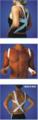 BodyAssist Postural Support