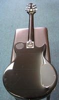GBA1