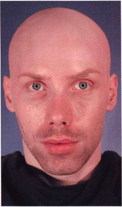 BALD CAP PIC