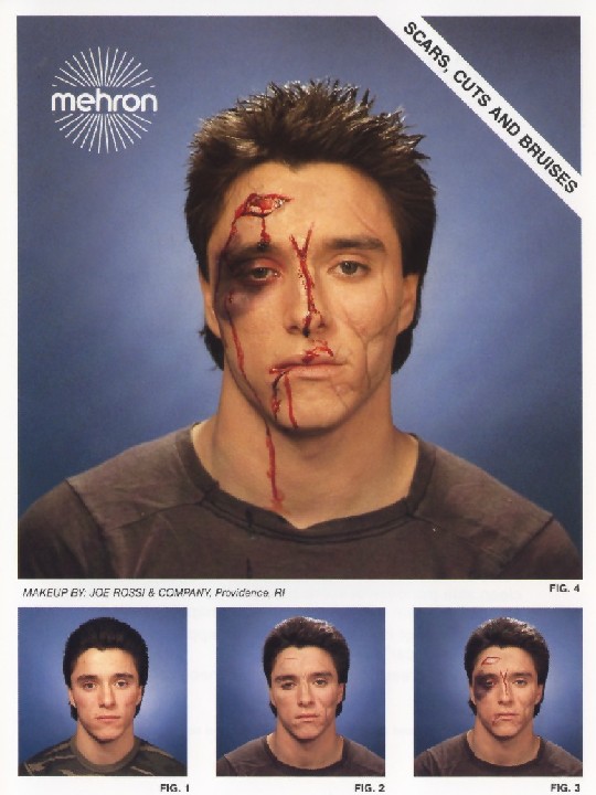 SCARS CUTS & BRUISES
