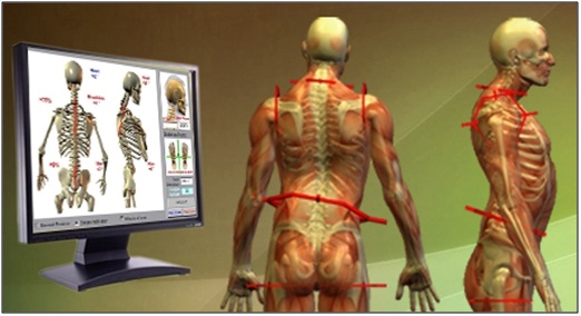 Postural Analysis 